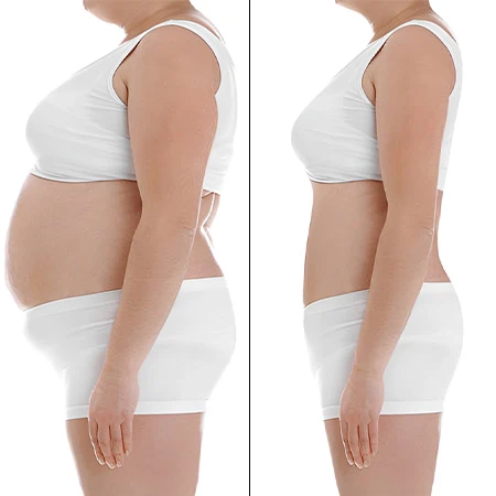 cryo-before-after-use