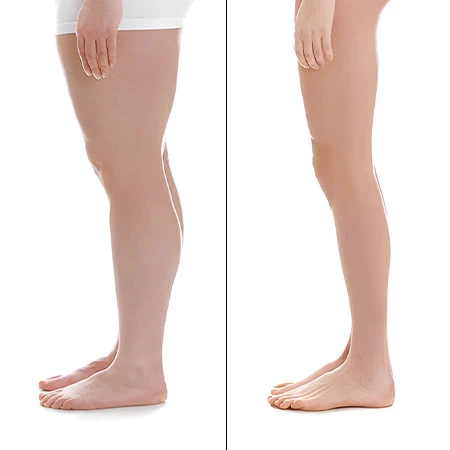 cryo-before-after-use
