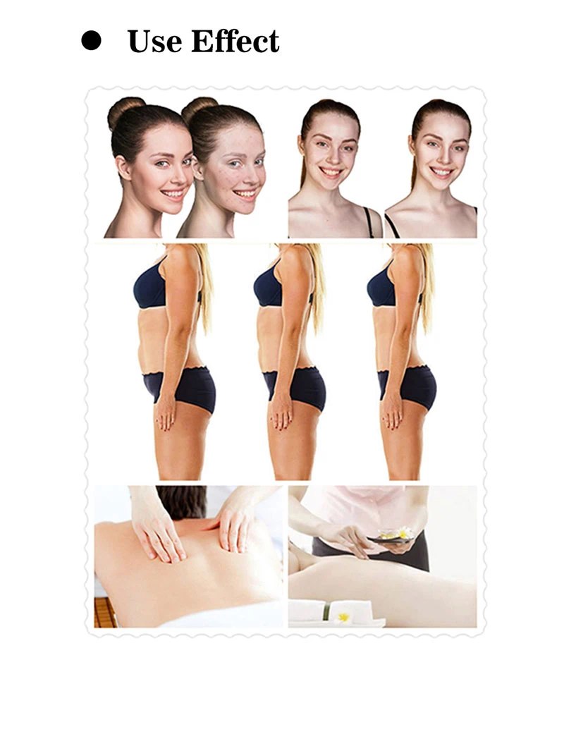 ems cryo rf facial body slimming