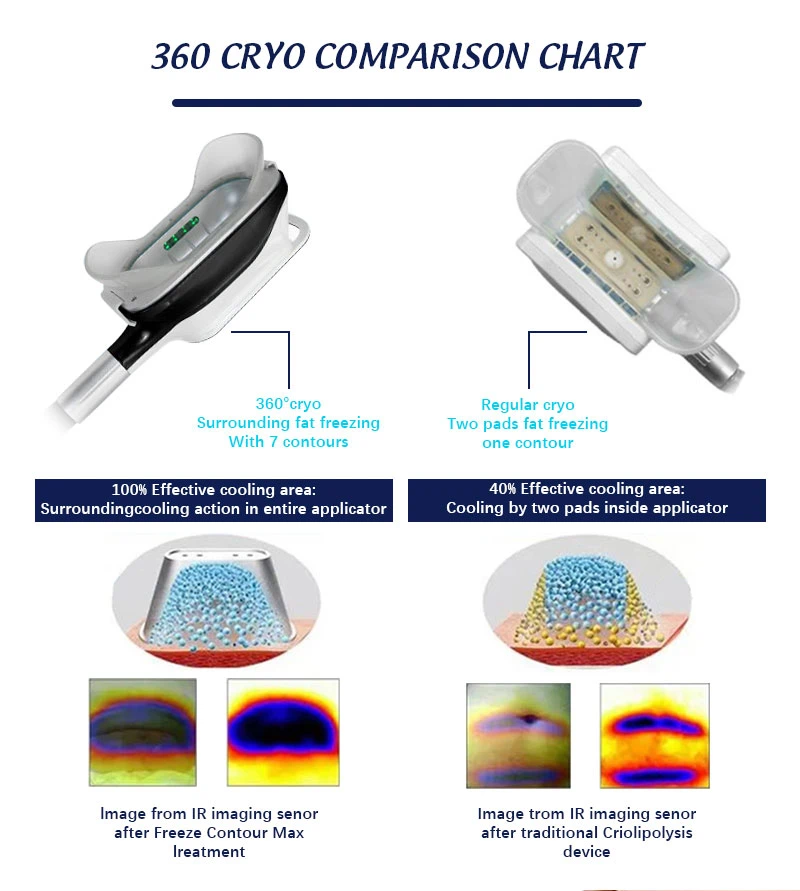 lipo laser body shaping