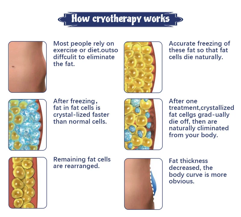how does cryolipolysis work
