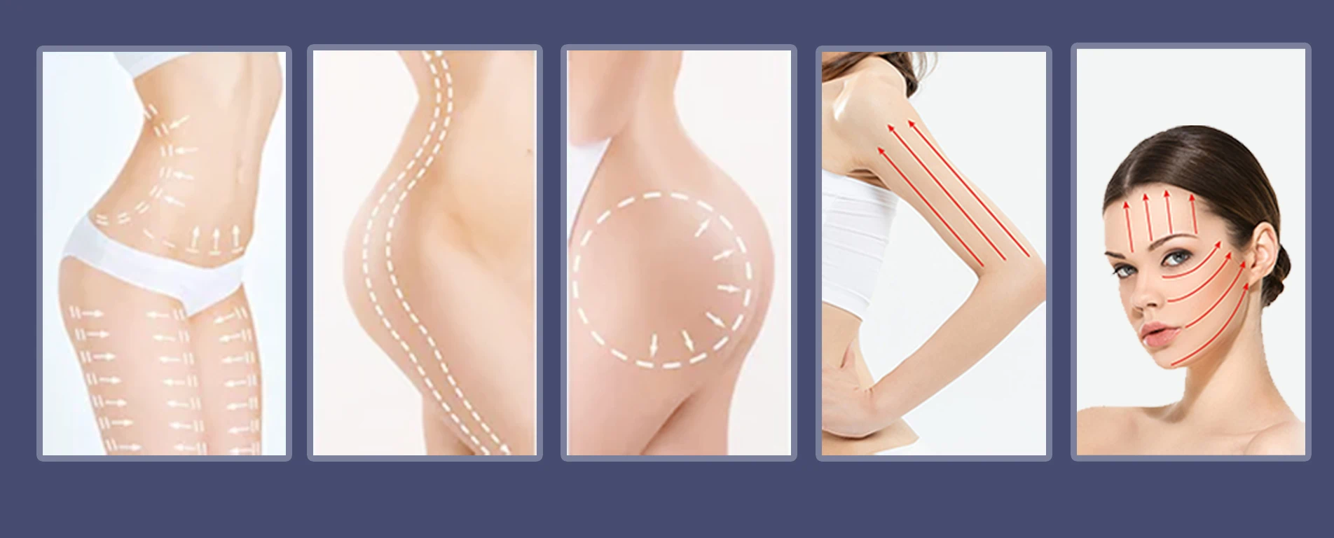 double cryo slimming device